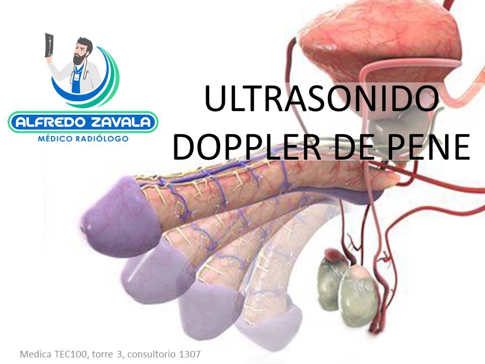 Ultrasonido Doppler de pene en Querétaro. 